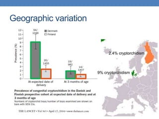 Geographic variation
9% cryptorchidism
2.4% cryptorchidism
 