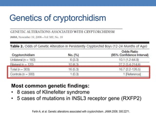 Genetics of cryptorchidism
Most common genetic findings:
• 8 cases of Klinefelter syndrome
• 5 cases of mutations in INSL3 receptor gene (RXFP2)
Ferlin A, et al. Genetic alterations associated with cryptorchidism. JAMA 2008; 300:2271.
 