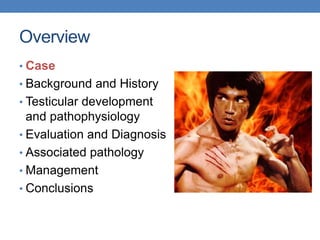 Overview
• Case
• Background and History
• Testicular development
and pathophysiology
• Evaluation and Diagnosis
• Associated pathology
• Management
• Conclusions
 