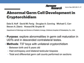 • Purpose: explore abnormalities in germ cell maturation in
UDTs and in descended contralateral testes.
• Methods: 737 boys with unilateral cryptorchidism
• Between birth and 9 years old
• Had orchiopexy and bilateral testicular biopsies
• Total and differential germ cell counts performed on sections
 