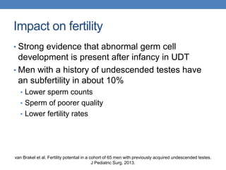 Impact on fertility
• Strong evidence that abnormal germ cell
development is present after infancy in UDT
• Men with a history of undescended testes have
an subfertility in about 10%
• Lower sperm counts
• Sperm of poorer quality
• Lower fertility rates
van Brakel et al. Fertility potential in a cohort of 65 men with previously acquired undescended testes.
J Pediatric Surg. 2013.
 