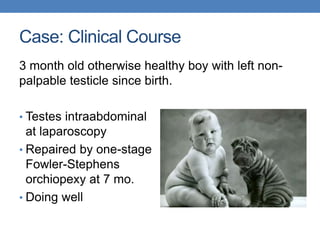 Case: Clinical Course
3 month old otherwise healthy boy with left non-
palpable testicle since birth.
• Testes intraabdominal
at laparoscopy
• Repaired by one-stage
Fowler-Stephens
orchiopexy at 7 mo.
• Doing well
 