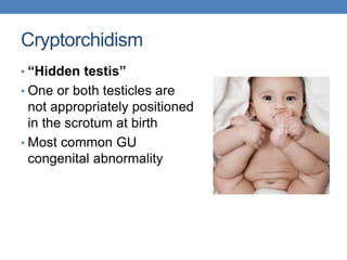 Cryptorchidism
• “Hidden testis”
• One or both testicles are
not appropriately positioned
in the scrotum at birth
• Most common GU
congenital abnormality
 