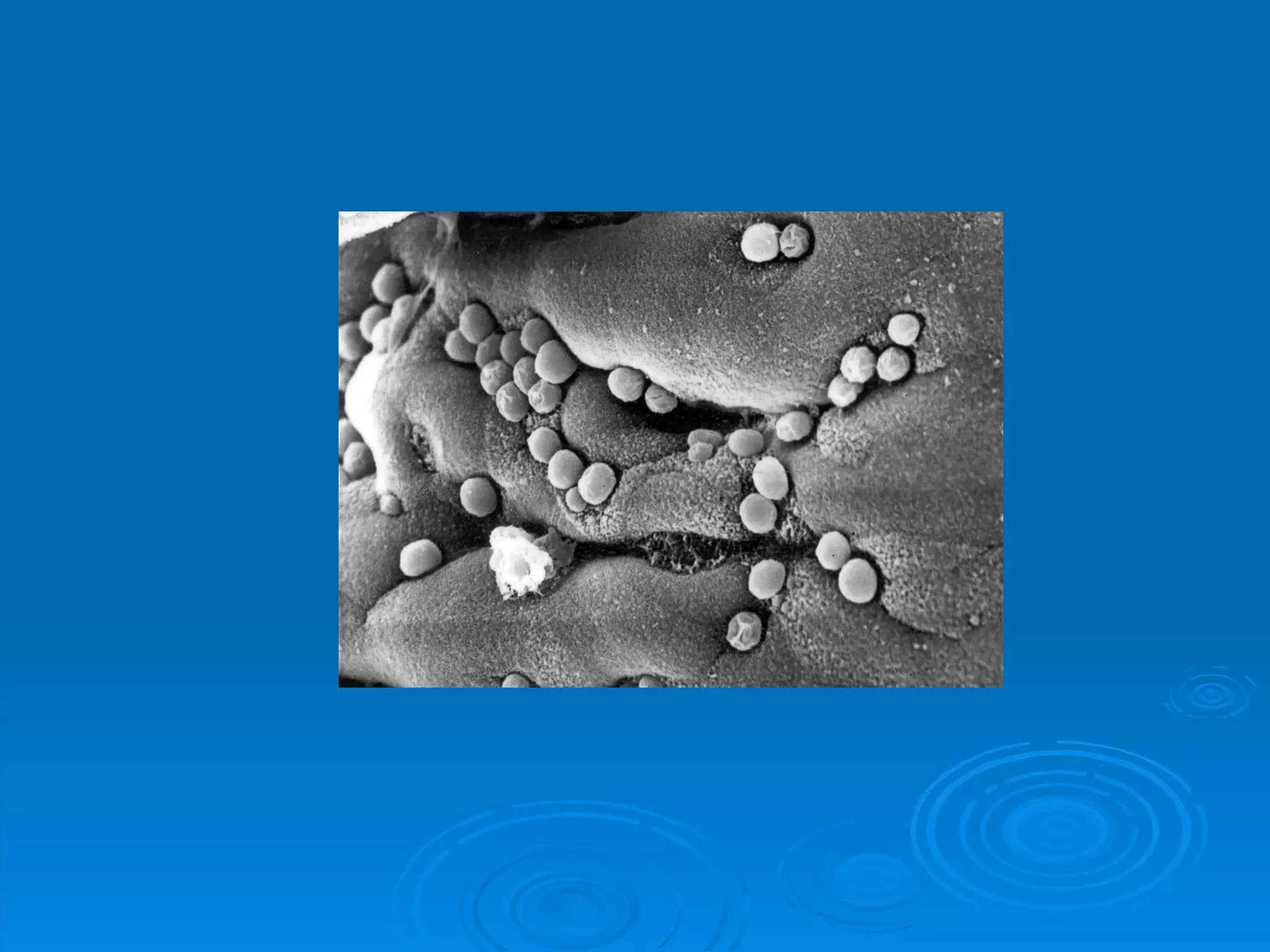 Cryptosporidium parvum | PPT