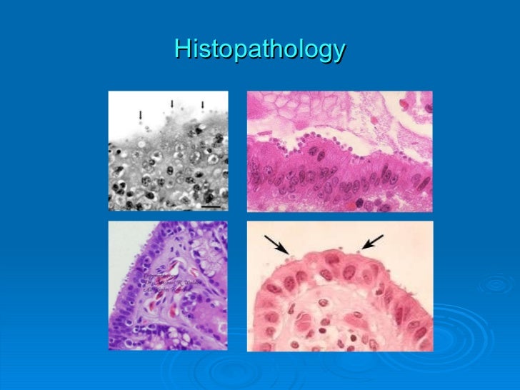 Cryptosporidium Parvum