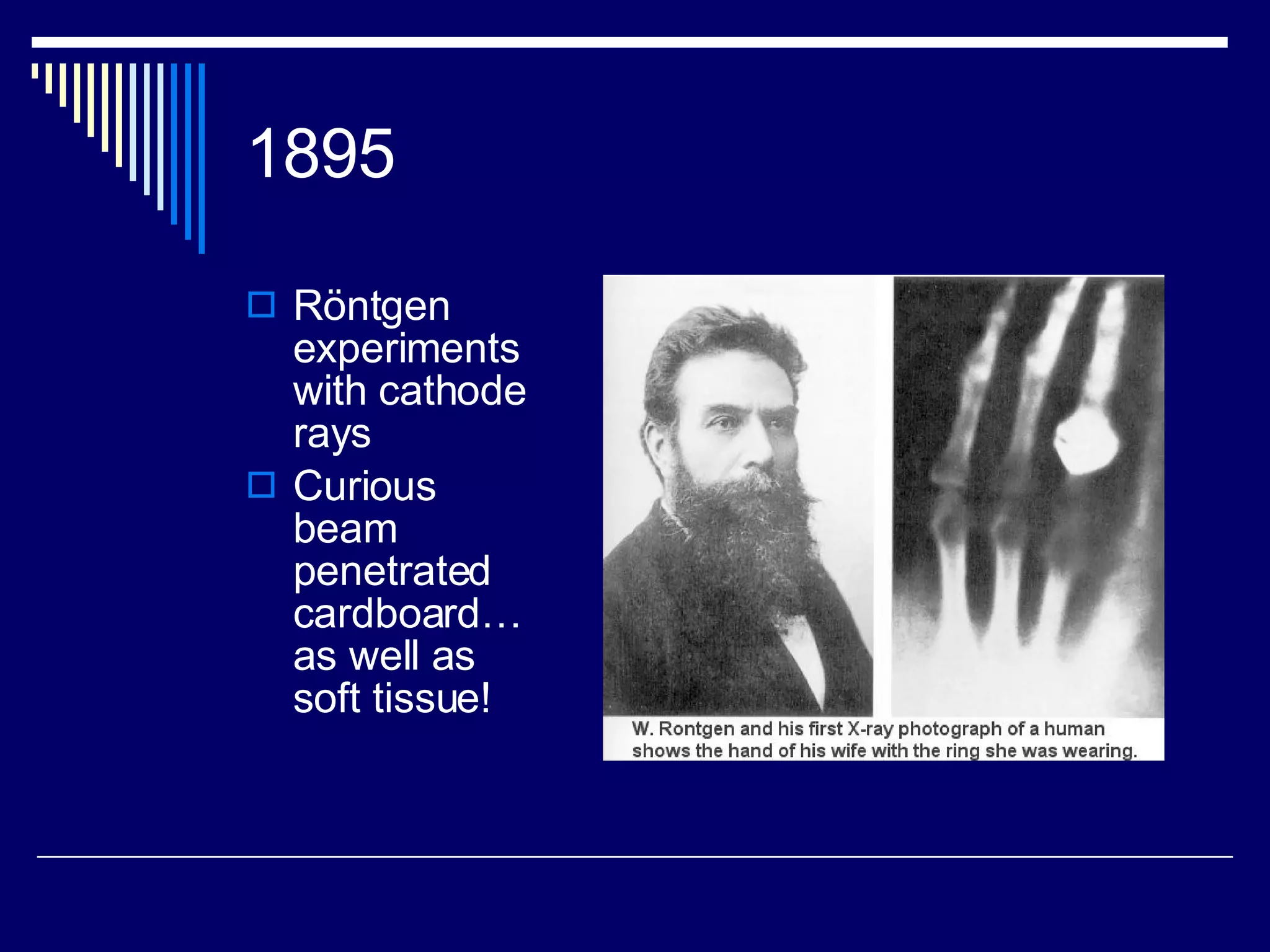 1895 R öntgen experiments with cathode rays Curious beam penetrated cardboard…as well as soft tissue! 