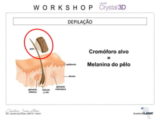 DEPILAÇÃO
Cromóforo alvo
=
Melanina do pêlo
 