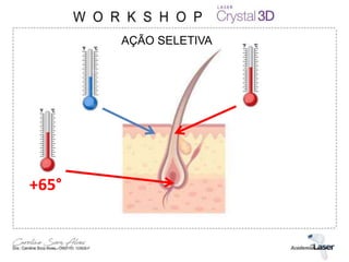 +65°
AÇÃO SELETIVA
 