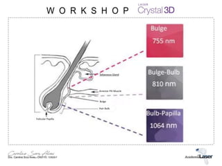 Folicular Papilla
Hair Bulb
Bulge
Arrector Pili Muscle
Sebaceous Gland
 