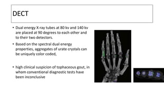 DECT
• Dual energy X-ray tubes at 80 kv and 140 kv
are placed at 90 degrees to each other and
to their two detectors.
• Based on the spectral dual energy
properties, aggregates of urate crystals can
be uniquely color coded,
• high clinical suspicion of tophaceous gout, in
whom conventional diagnostic tests have
been inconclusive
 