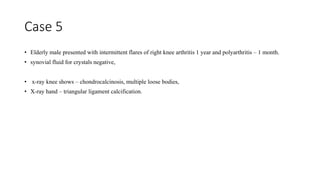 Case 5
• Elderly male presented with intermittent flares of right knee arthritis 1 year and polyarthritis – 1 month.
• synovial fluid for crystals negative,
• x-ray knee shows – chondrocalcinosis, multiple loose bodies,
• X-ray hand – triangular ligament calcification.
 