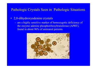 Crystal ua | PDF