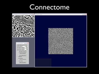 Connectome
 
