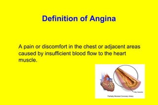 Chronic Stable Angina- Diagnosis & management | PPT