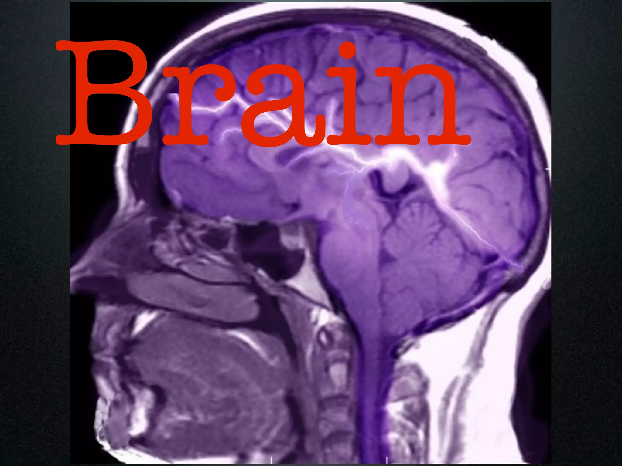 Brain
 