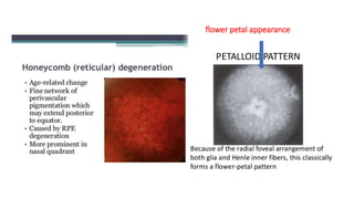 Cscr ( central serous chorioretinopathy ) | PPTX