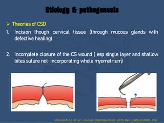 Defective Csd Examples Cesarean Scar defect CSD ................ | PDF