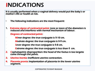 Cesarean Section - Procedure & Management - Dr Rohit Bhaskar | PPT