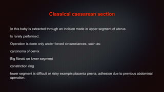Classical caesarean section
In this baby is extracted through an incision made in upper segment of uterus.
Is rarely performed.
Operation is done only under forced circumstances, such as:
carcinoma of cervix
Big fibroid on lower segment
constriction ring
lower segment is difficult or risky example:placenta previa, adhesion due to previous abdominal
operation.
 