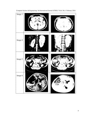 IMAGE SEGMENTATION BY USING THRESHOLDING TECHNIQUES FOR MEDICAL IMAGES ...