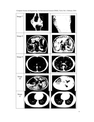 IMAGE SEGMENTATION BY USING THRESHOLDING TECHNIQUES FOR MEDICAL IMAGES ...