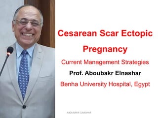 Cesarean Scar Ectopic
Pregnancy
Current Management Strategies
Prof. Aboubakr Elnashar
Benha University Hospital, Egypt
ABOUBAKR ELNASHAR
 