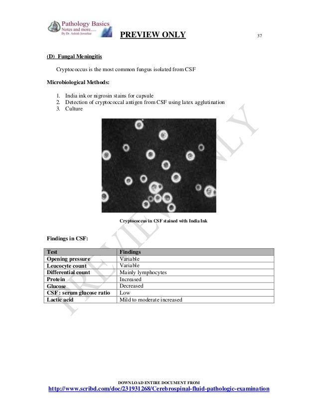 D-CSF-SC-23 Dumps Deutsch
