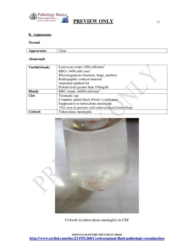 CSF Cerebrospinal fluid examination from tapping to pathological