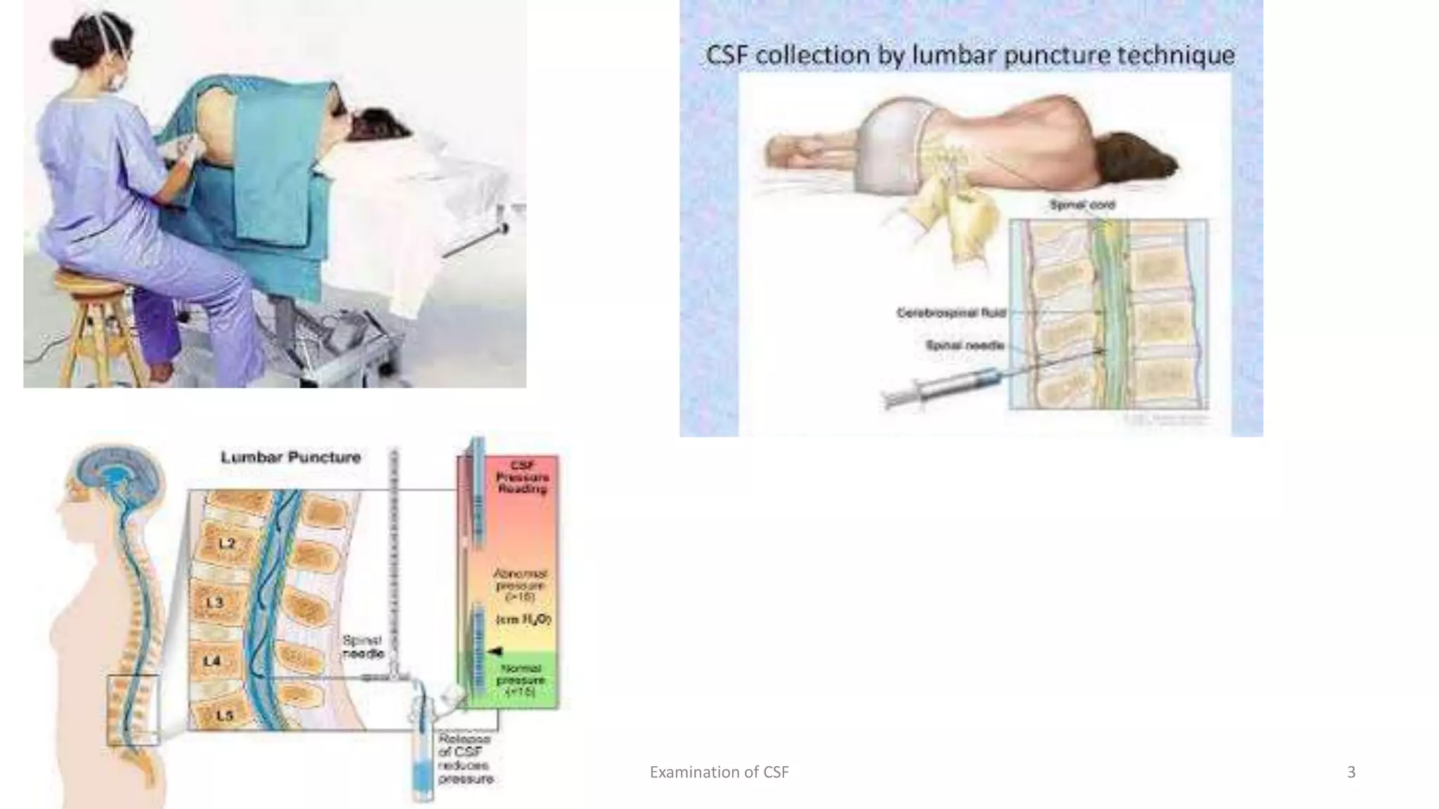 10/29/2021 Examination of CSF 3
 