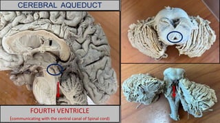 CEREBRAL AQUEDUCT
FOURTH VENTRICLE
(communicating with the central canal of Spinal cord)
 