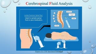 CSF General Information And Laboratory Finding | PDF