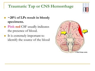 CSF CNS covered by 3 membranes [meninges] pdf | PDF