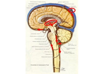 Comprehensive Overview of Cerebrospinal Fluid: Physiology, Function ...
