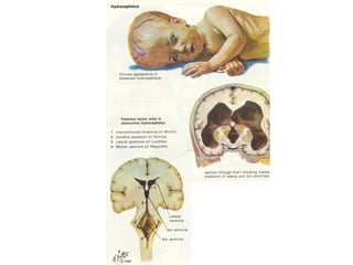 Comprehensive Overview of Cerebrospinal Fluid: Physiology, Function ...