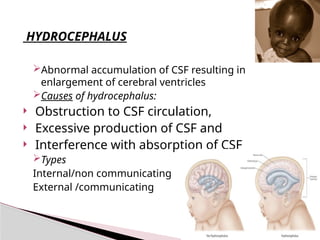 Comprehensive Overview of Cerebrospinal Fluid: Formation, Function, and ...