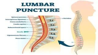 CSF-Pathway all aspect covered (anatomical and physiological) | PPTX
