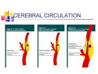 CEREBRAL CIRCULATION
 