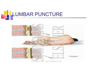 LUMBAR PUNCTURE
 