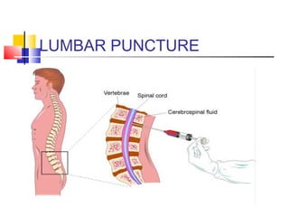 LUMBAR PUNCTURE
 