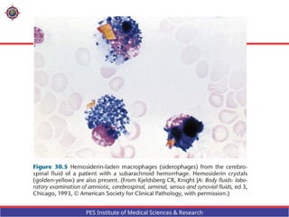 CSF ,gross examination, Approach to CSF analysis , indications .pptx