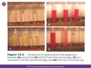 CSF analysis and its clinical applications | PPTX