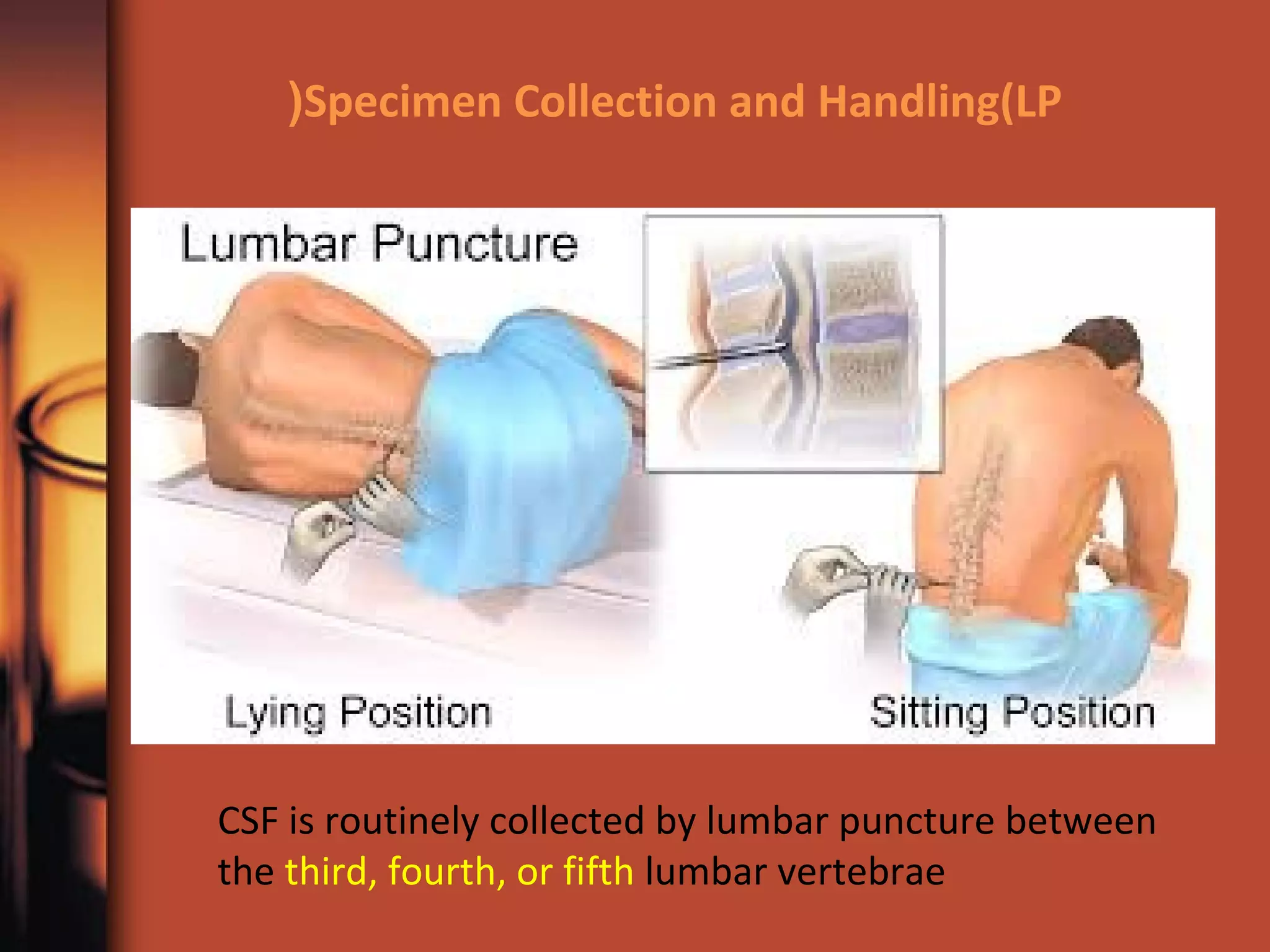Specimen Collection and Handling(LP(
CSF is routinely collected by lumbar puncture between
the third, fourth, or fifth lumbar vertebrae
 