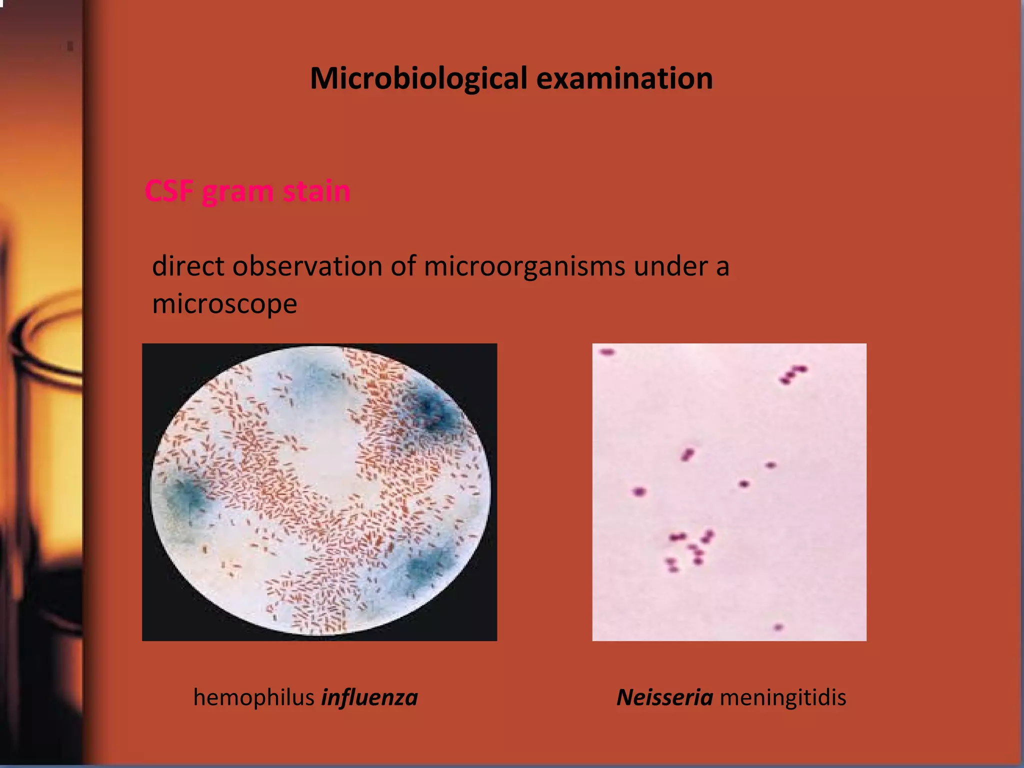 CSF gram stain
direct observation of microorganisms under a
microscope
hemophilus influenza Neisseria meningitidis
Microbiological examination
 