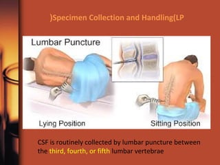 Specimen Collection and Handling(LP(
CSF is routinely collected by lumbar puncture between
the third, fourth, or fifth lumbar vertebrae
 