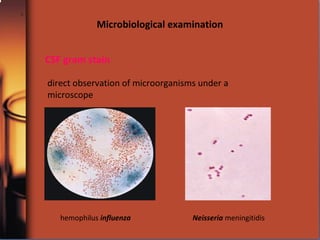 CSF gram stain
direct observation of microorganisms under a
microscope
hemophilus influenza Neisseria meningitidis
Microbiological examination
 
