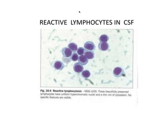 `
REACTIVE LYMPHOCYTES IN CSF
 