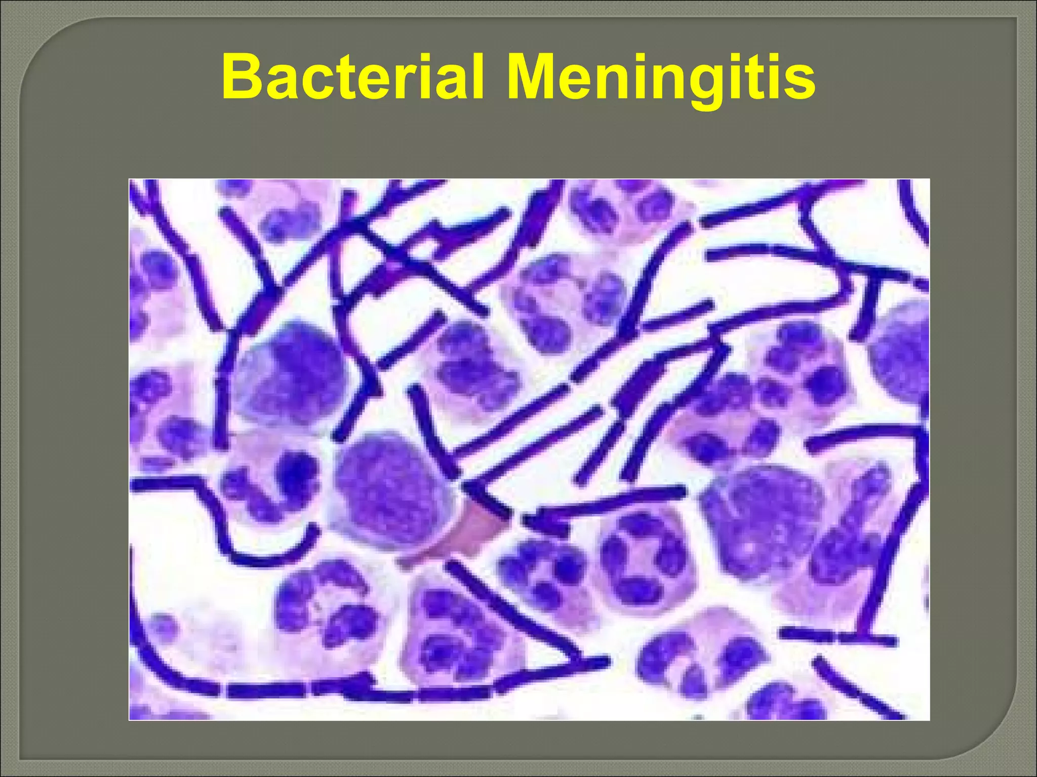 Bacterial Meningitis 