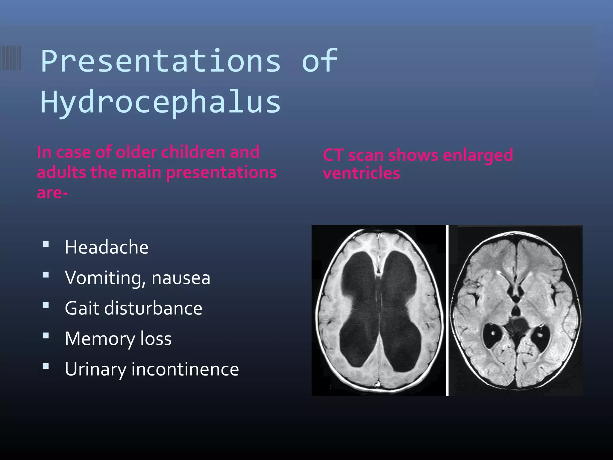 CSF and it’s abnormalities | PPT
