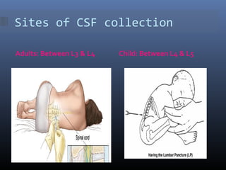 Position For Csf Collection CSF and it’s abnormalities | PPT
