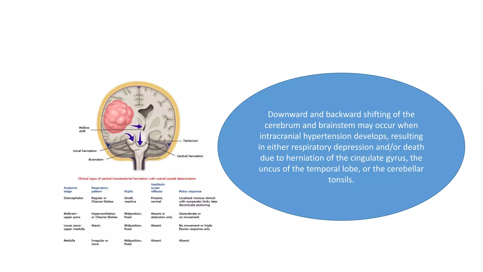 Downward and backward shifting of the
cerebrum and brainstem may occur when
intracranial hypertension develops, resulting
in either respiratory depression and/or death
due to herniation of the cingulate gyrus, the
uncus of the temporal lobe, or the cerebellar
tonsils.
 